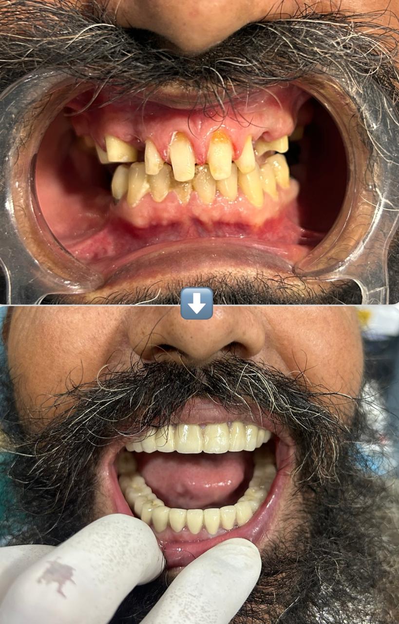 Patient Image