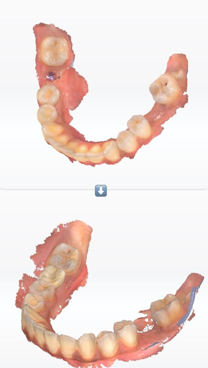 Patient Image