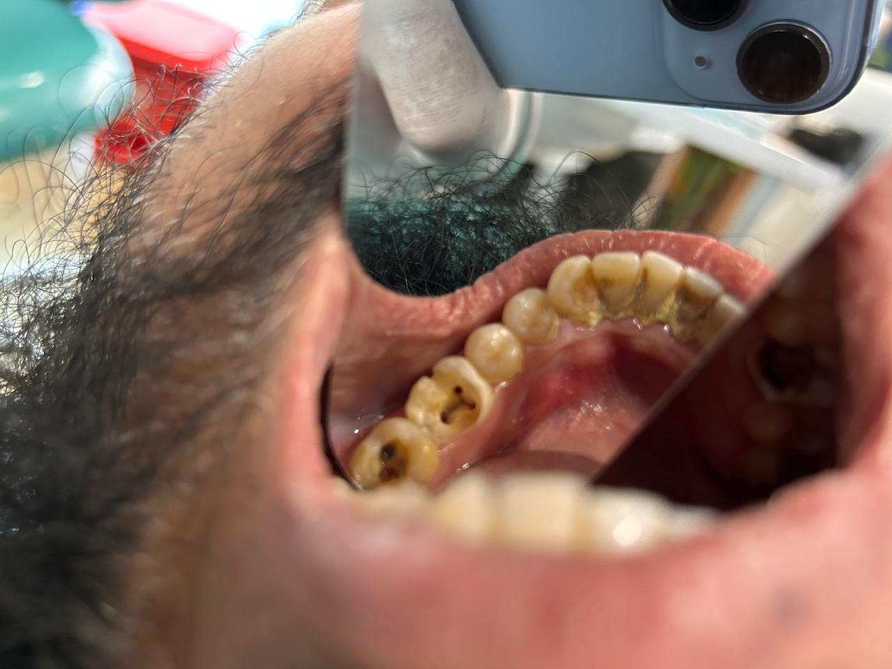 Patient Image
