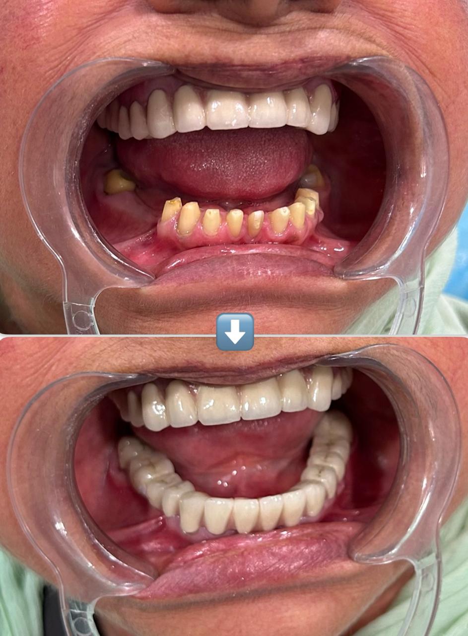Patient Image