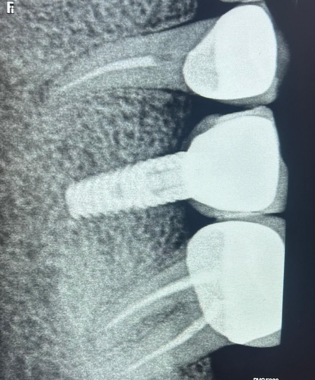 Patient Image