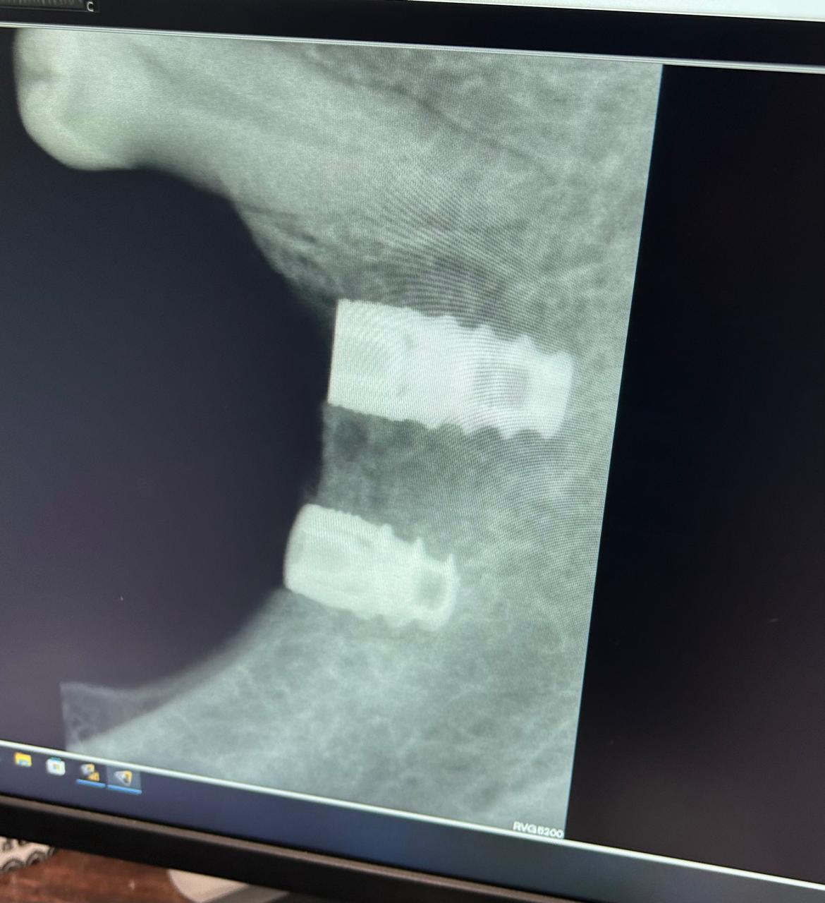Patient Image